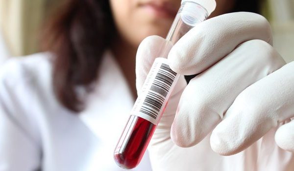 Новый анализ крови определяет меланому на ранней стадии